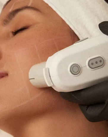 Ultherapy