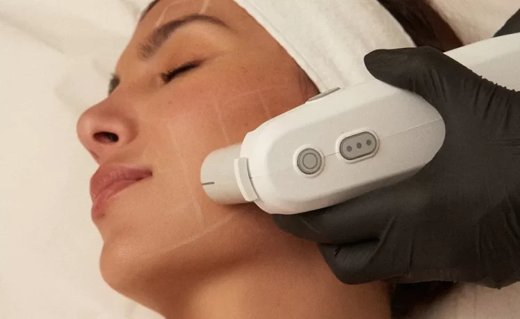 Ultherapy